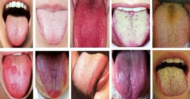 Будь-ласка обов’язково перевірте колір вашого язика, він розповість все nро стан здоров’я