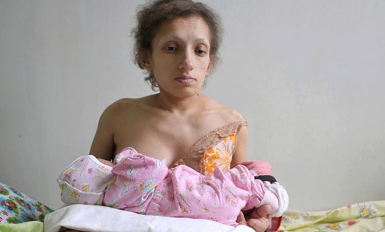 “Був сильний біль”: на Львівщині померла найнижча мама в Україні. фото
